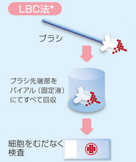 宮頸 ん 子 確率 が 再 検査 子宮腟部びらんの症状・原因・治療法 [子宮の病気]